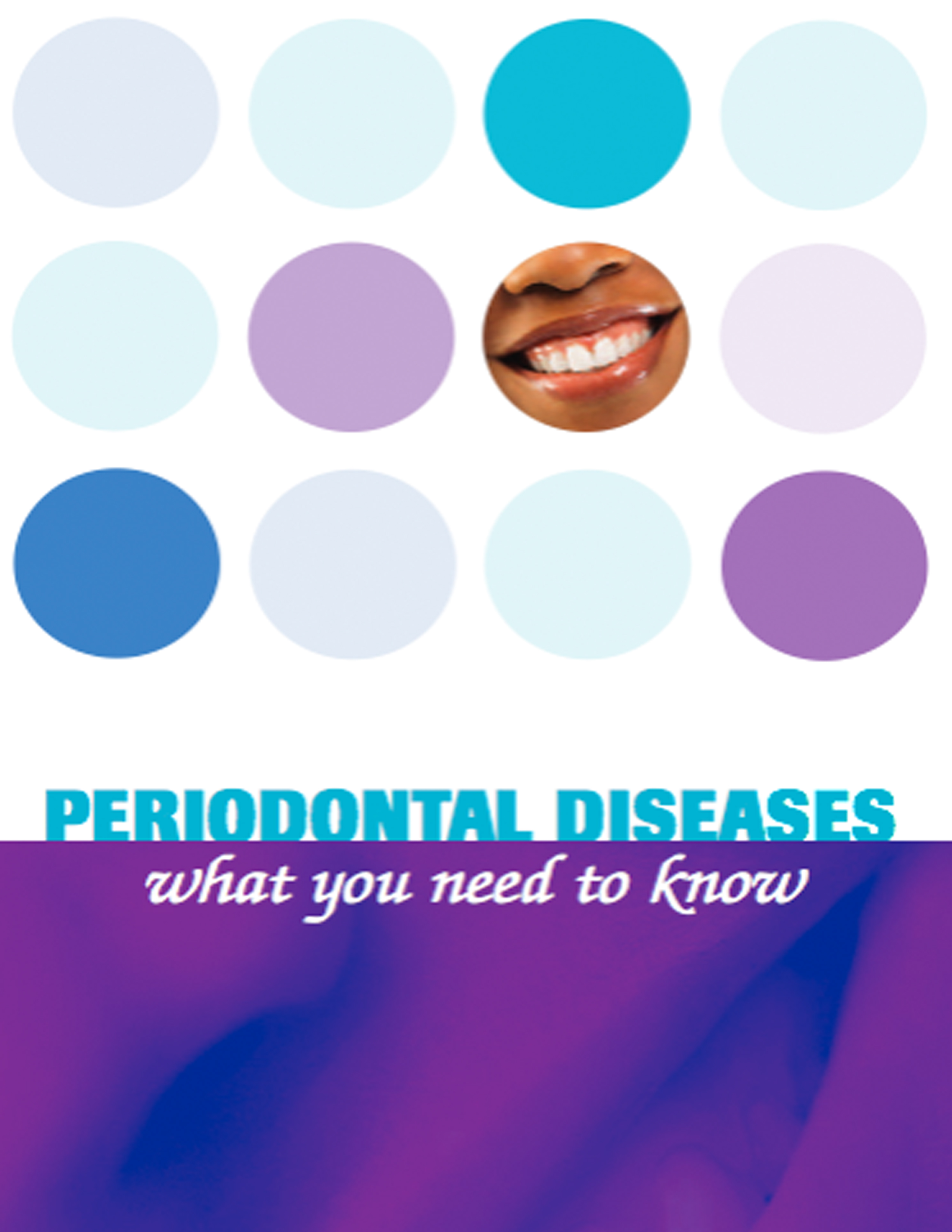 Periondontal Disease: What You Need To Know
