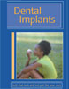 Dental Implants - AAP Brochure 