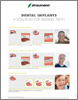 A Visual Guide to Dental Implants