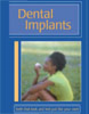 Dental Implants - AAP Brochure 