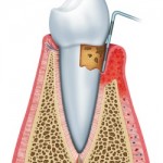 periodontist Manhattan