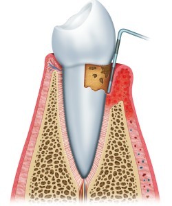 periodontist Manhattan