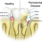 periodontist upper east side