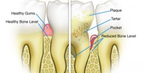 periodontist upper east side