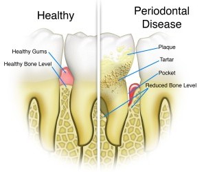 periodontist upper east side