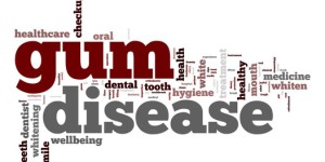 gum disease treatment Manhattan
