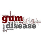 gum-disease-word-cloud