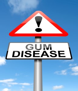 gum disease treatment Manhattan