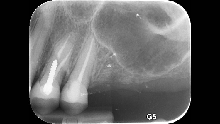 x-rays of patient Judith E.