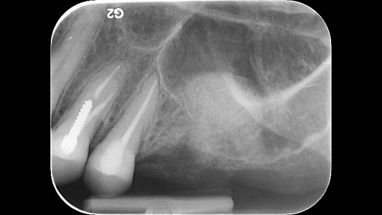 x-rays of patient Judith E.