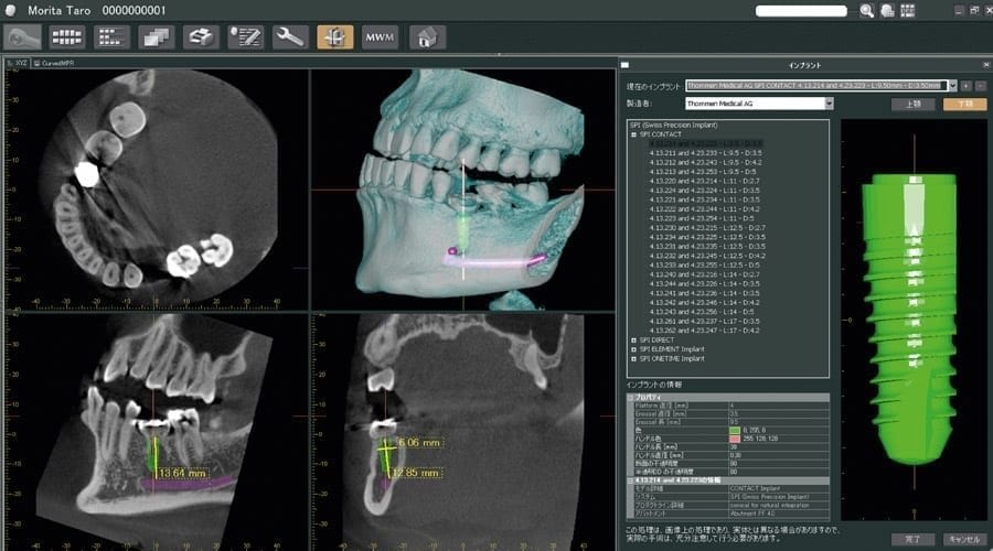 cbct technology image